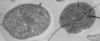 Wild type pollen grain (left) vs. <i>Legwd</i> mutant pollen grain (right). The mutant pollen grains express enlarged starch granules.